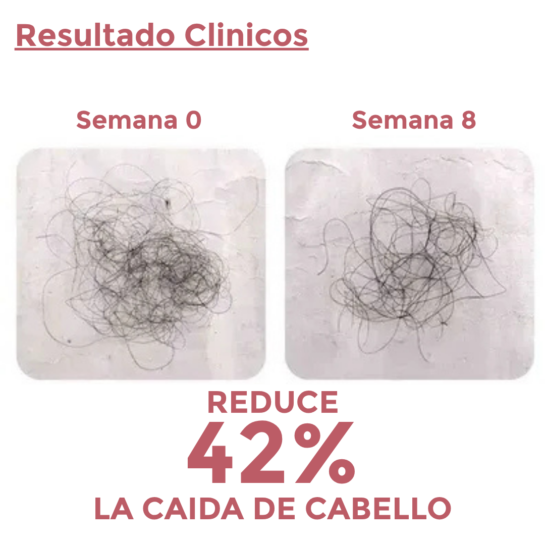 Capsulas Anti-Caida 1 Mes