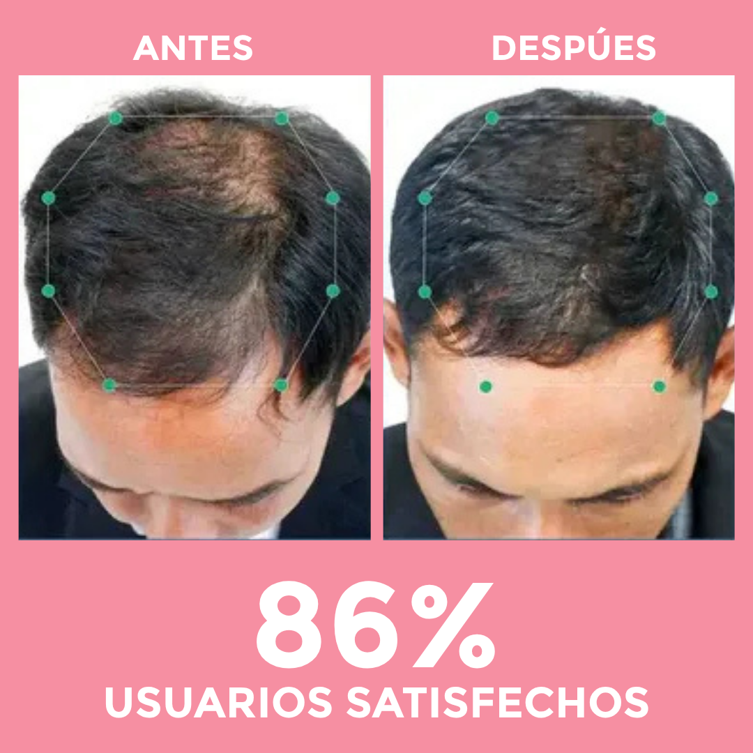 Capsulas Anti-Caida 1 Mes