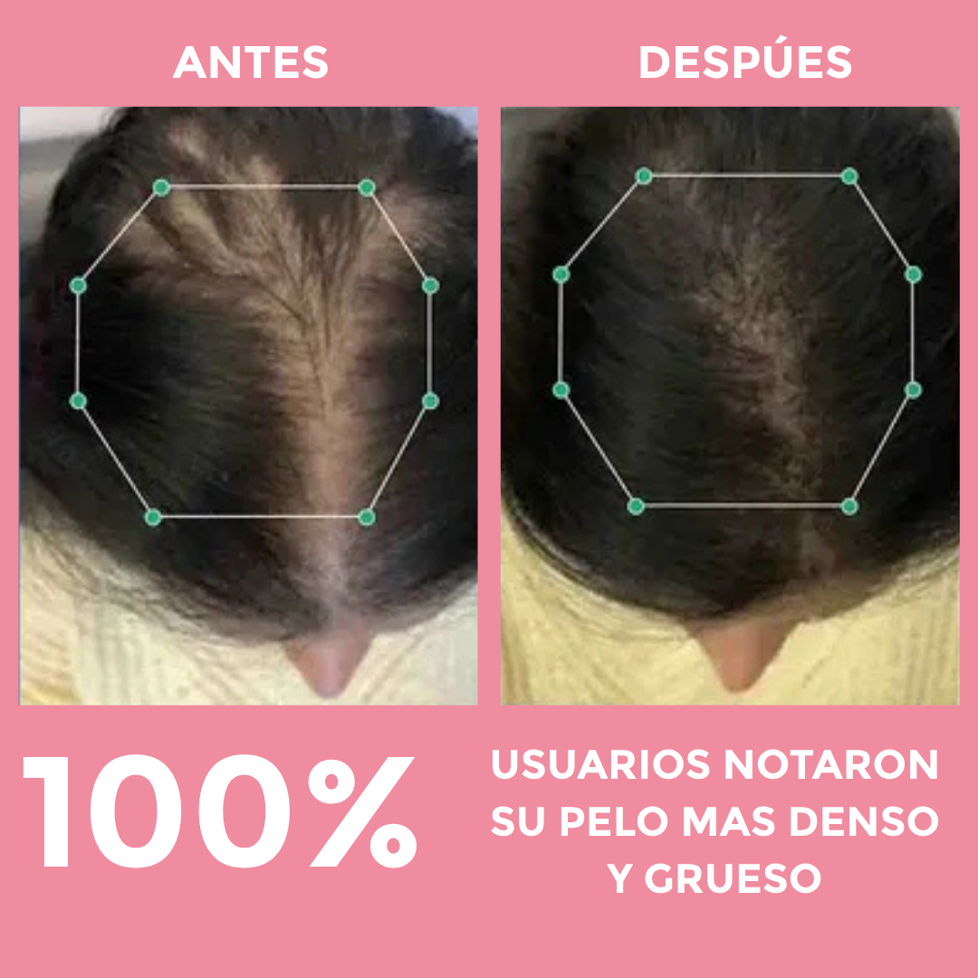 Capsulas Anti-Caida 1 Mes