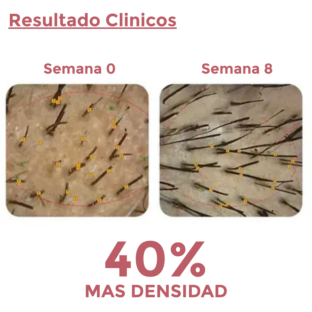 Capsulas Anti-Caida 1 Mes