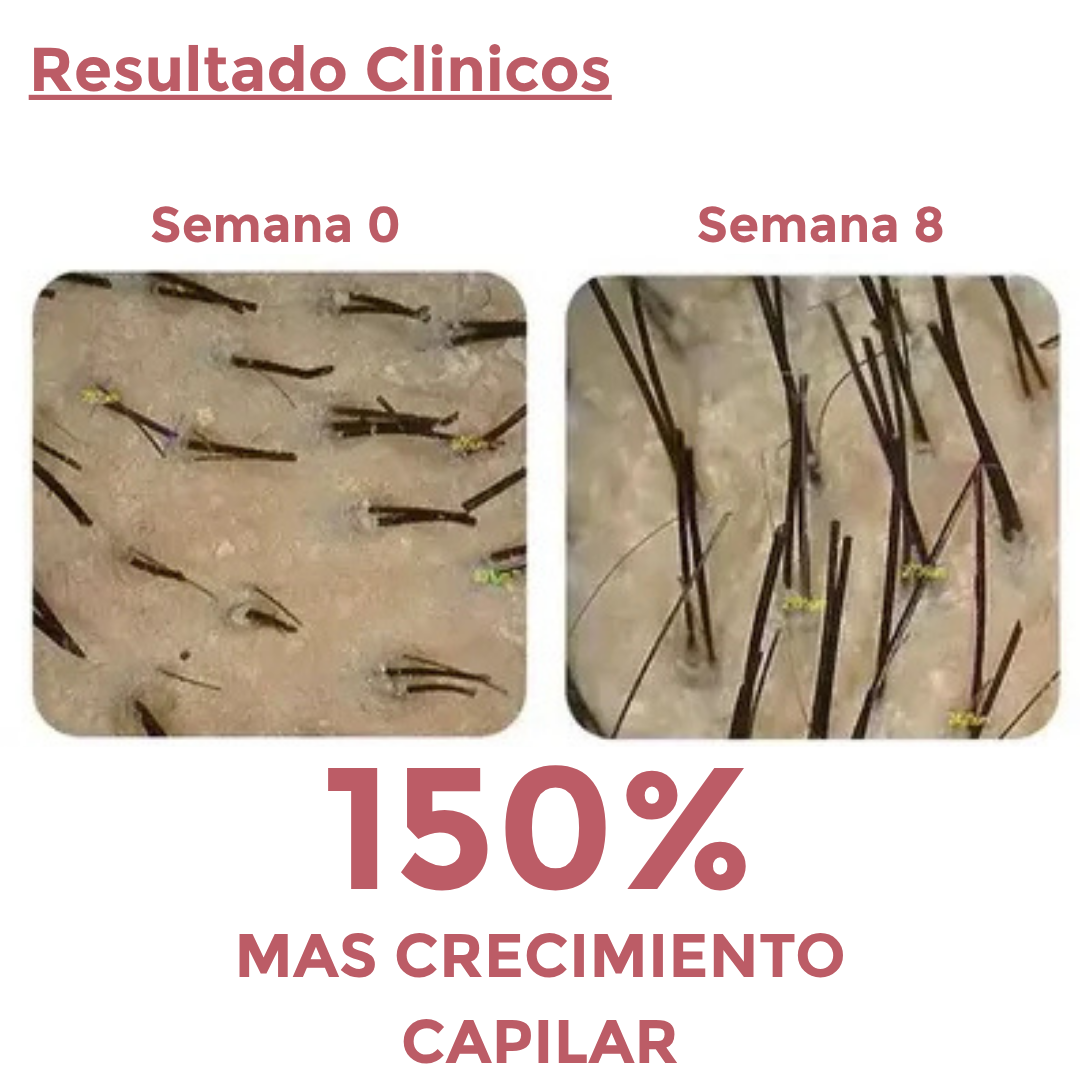 Capsulas Anti-Caida 1 Mes