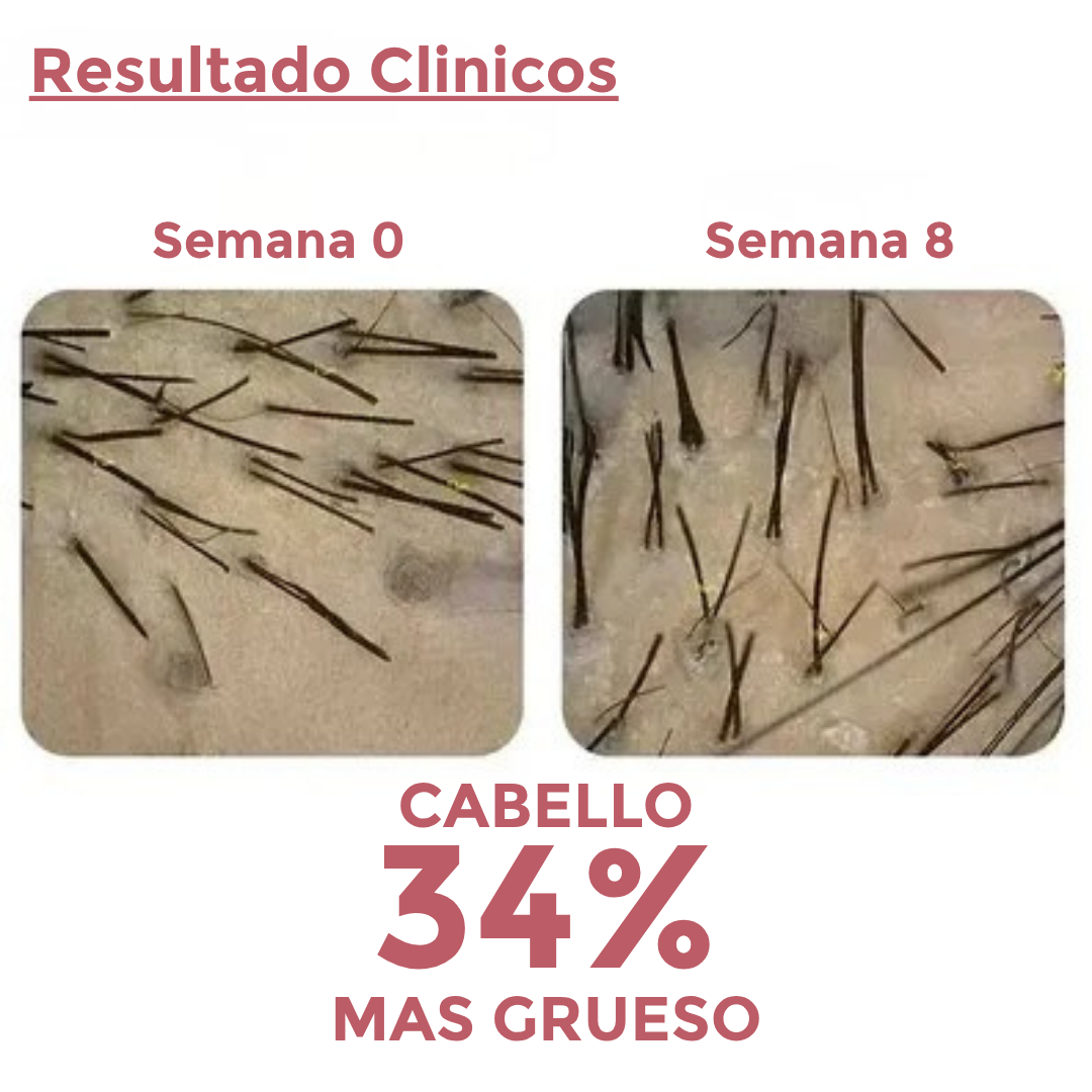 Capsulas Anti-Caida 1 Mes