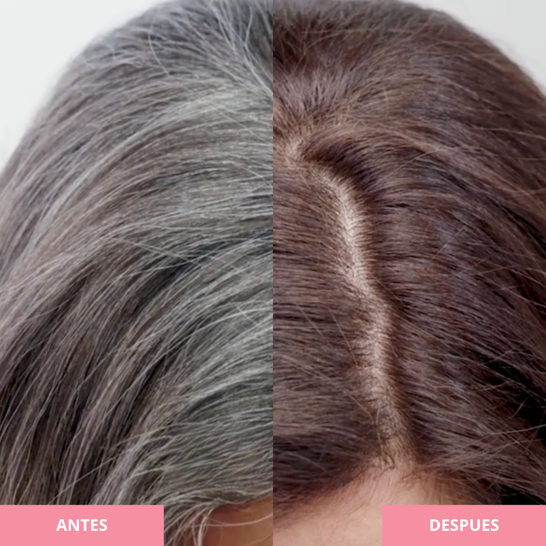 🚨PROMO 5x2 SERUM REVIVE-CANAS